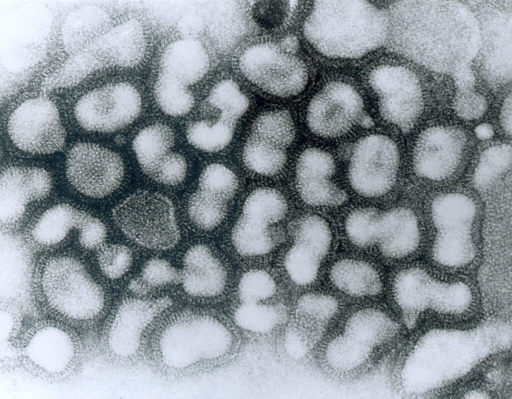 (imagem/ref: Microfotografia de Influenzavirus A, Centers for Disease Control and Prevention's Public Health Image Library)