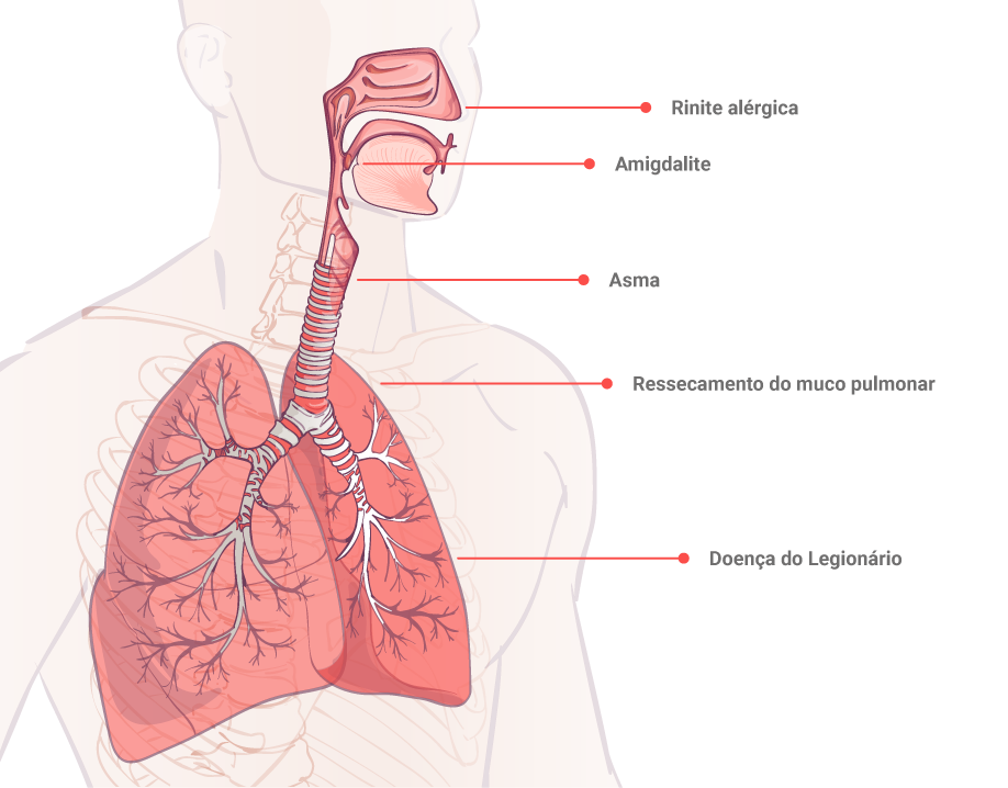 infográfico-doenças-respiratórias